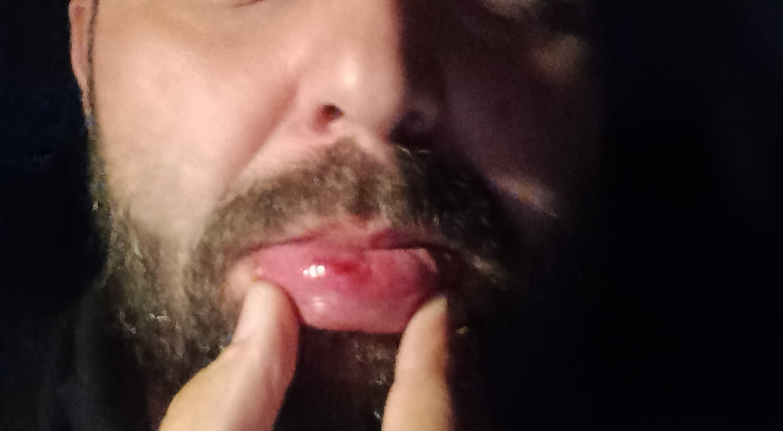 Leandro do Blog Política Velho Oeste é Agredido pelo Vereador Mauri Schaffer e Seus Irmãos: Ataque à Imprensa de Cascavel!